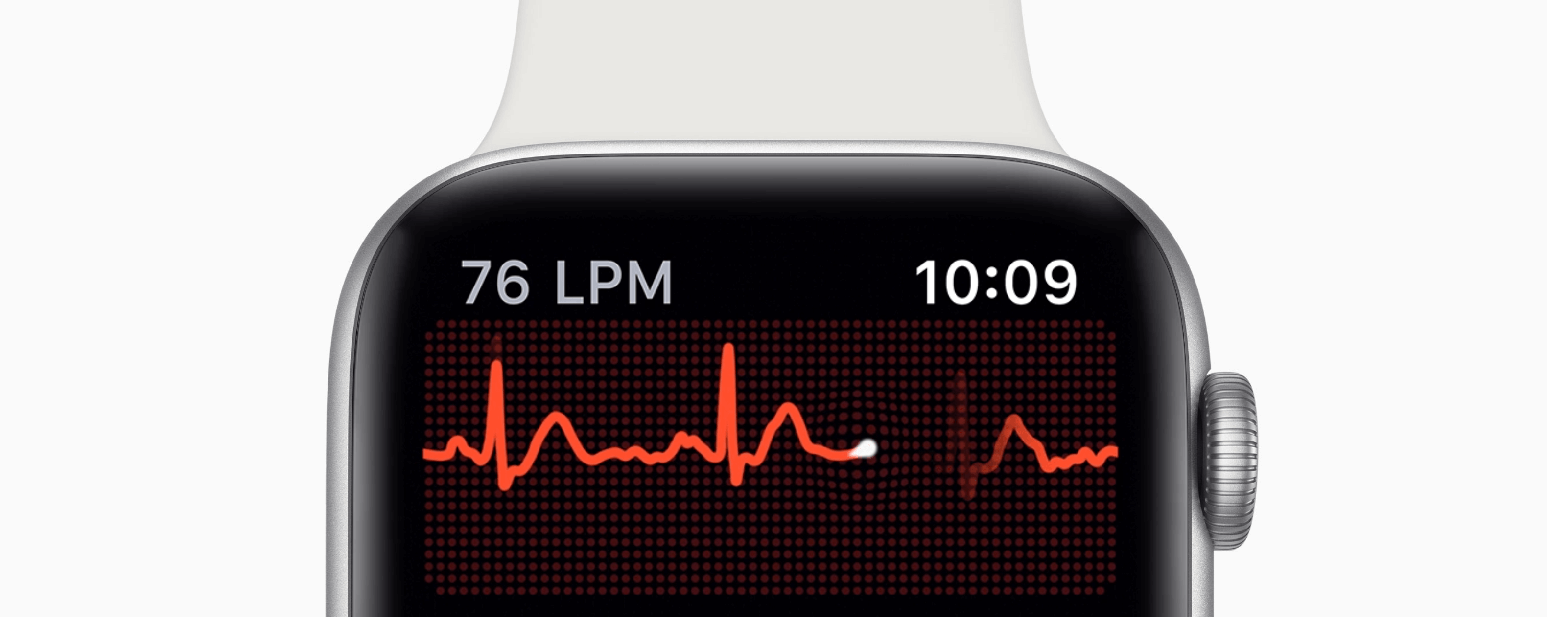 Algunos detalles sobre el electrocardiograma del Apple Watch